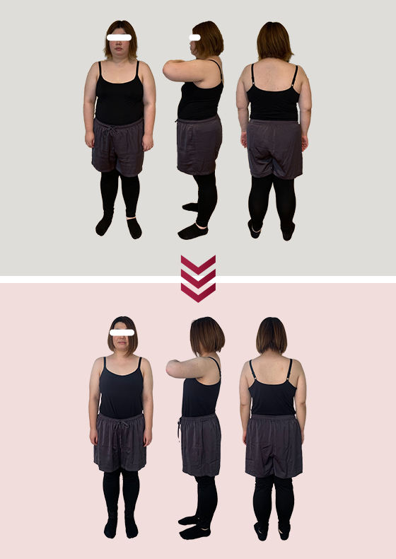 BEFORE & AFTER