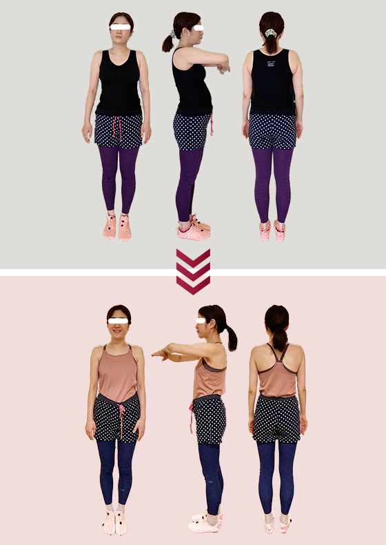 BEFORE & AFTER